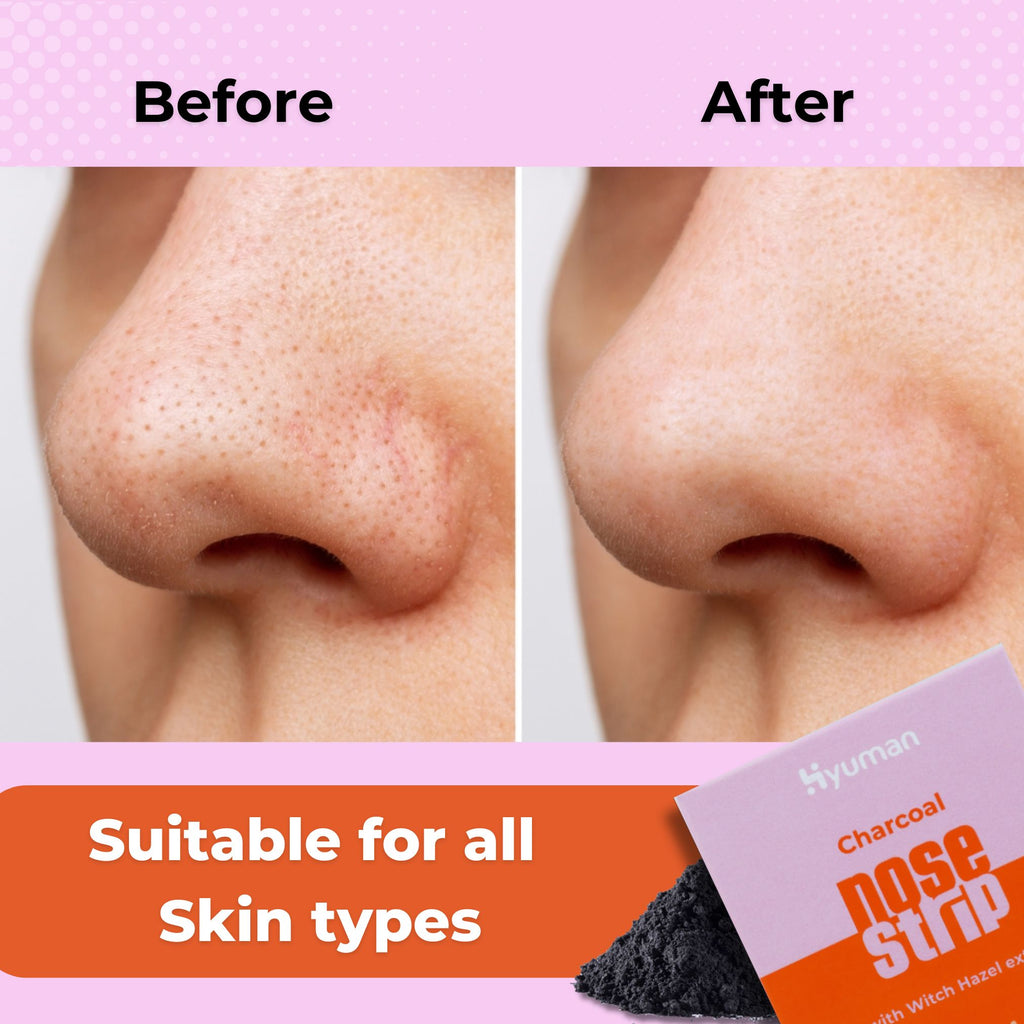 Nose Strip for Blackhead Whitehead Remover