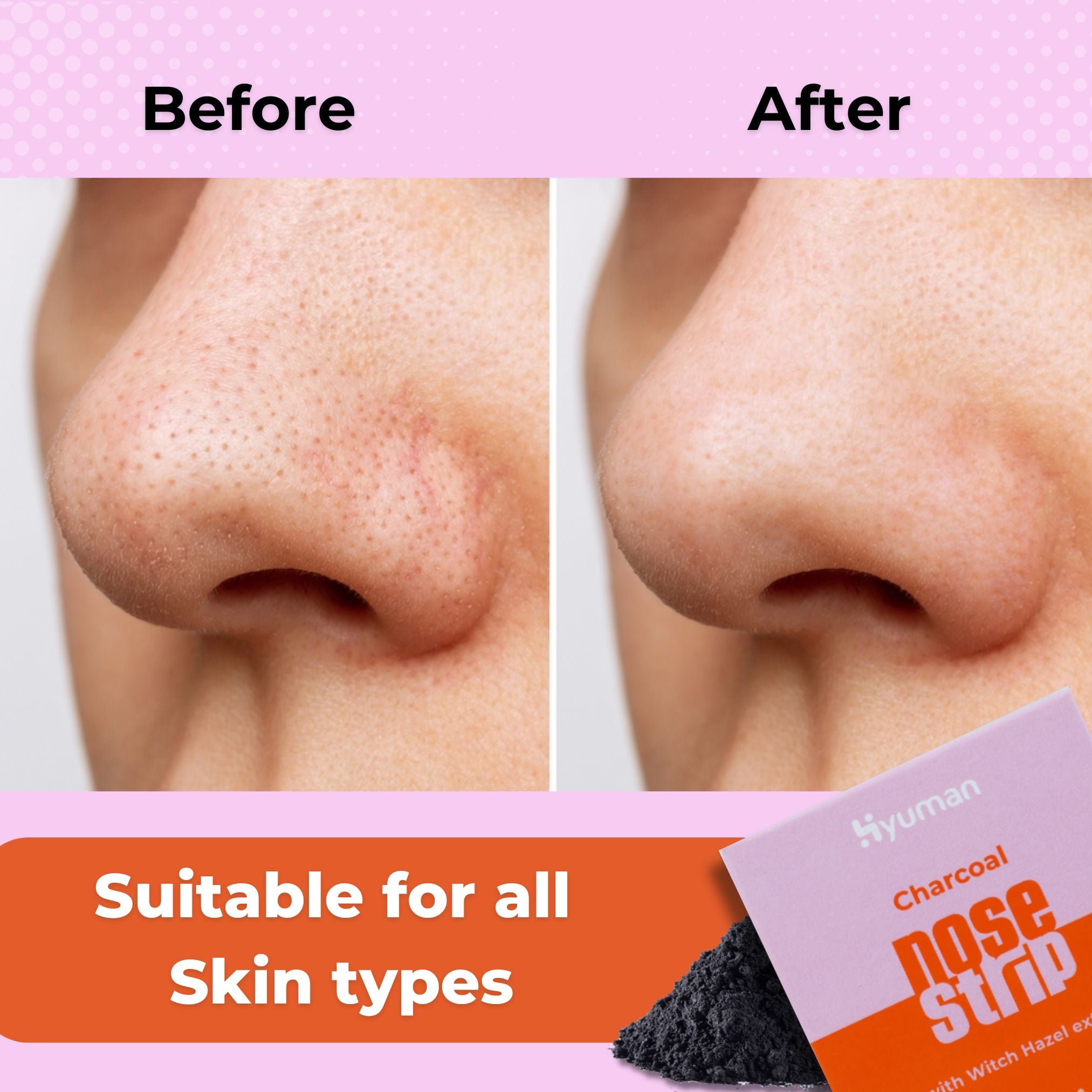 Nose Strip for Blackhead Whitehead Remover