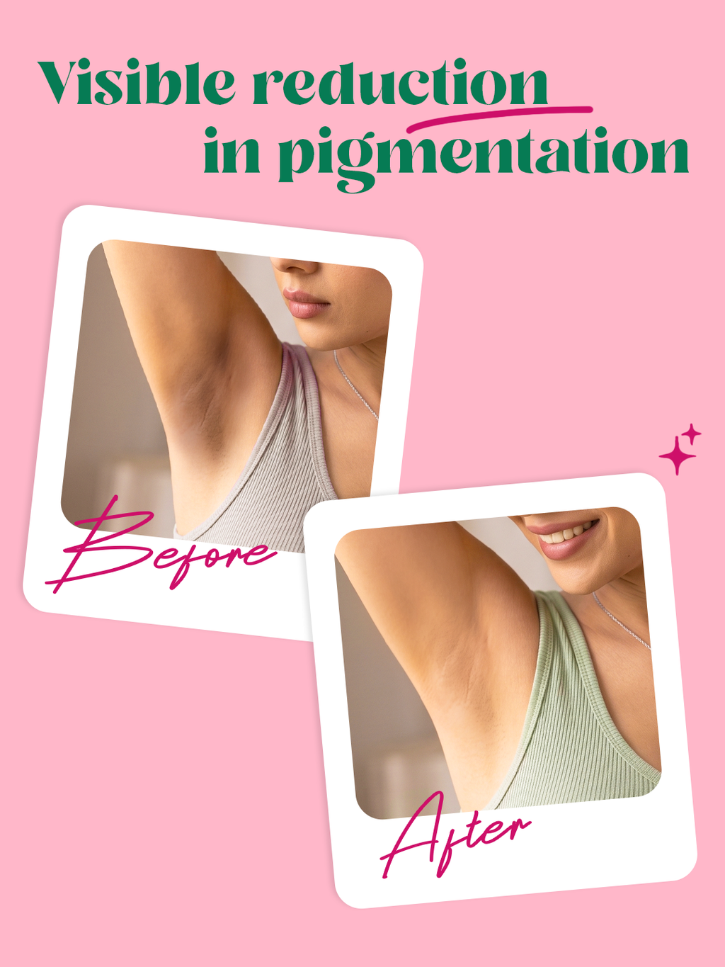 Underarm Roll-On for Brightening & Odour Control