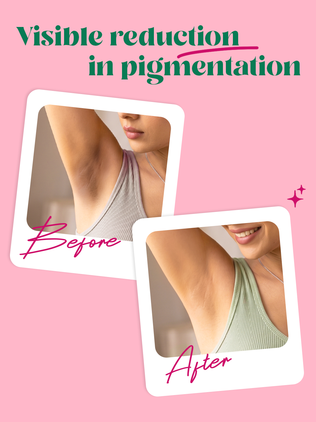 Underarm Roll-On for Brightening & Odour Control